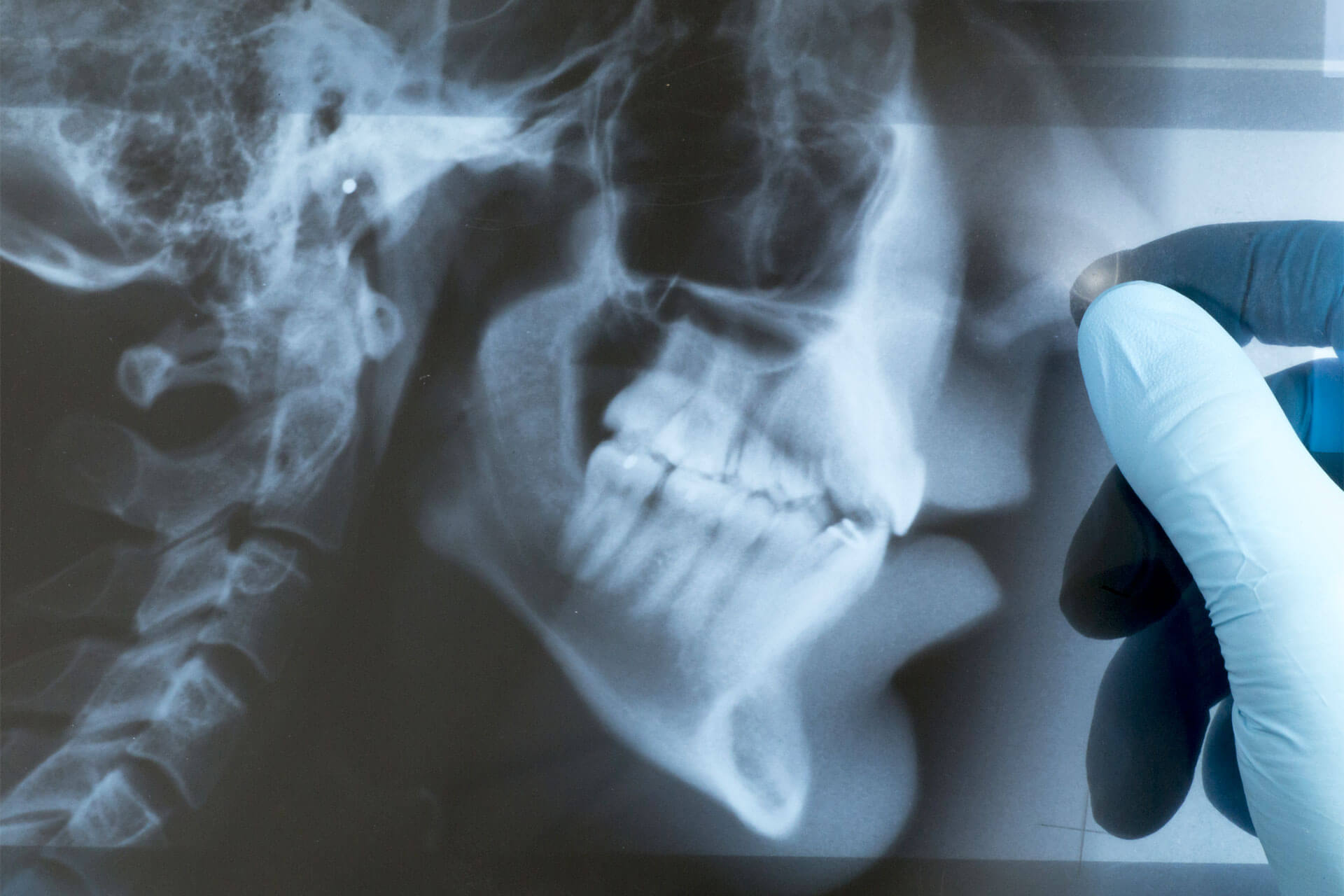 emergency dental care x-ray image
