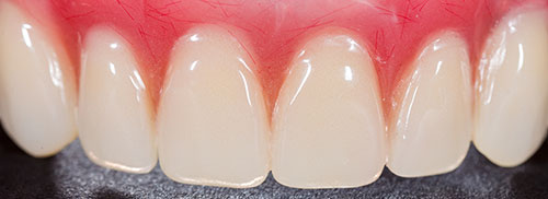 Prosthodontics-Olathe-Dental-Care-Center-home
