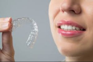 Olathe Dental Care Center invisible braces SureSmile clear aligners blog