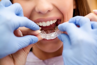 invisible braces olathe dental care center teens and adults