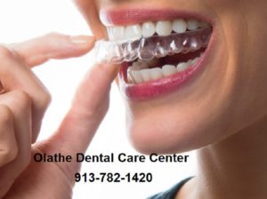 Olathe Dental Care Center SureSmile Invisible Braces blog